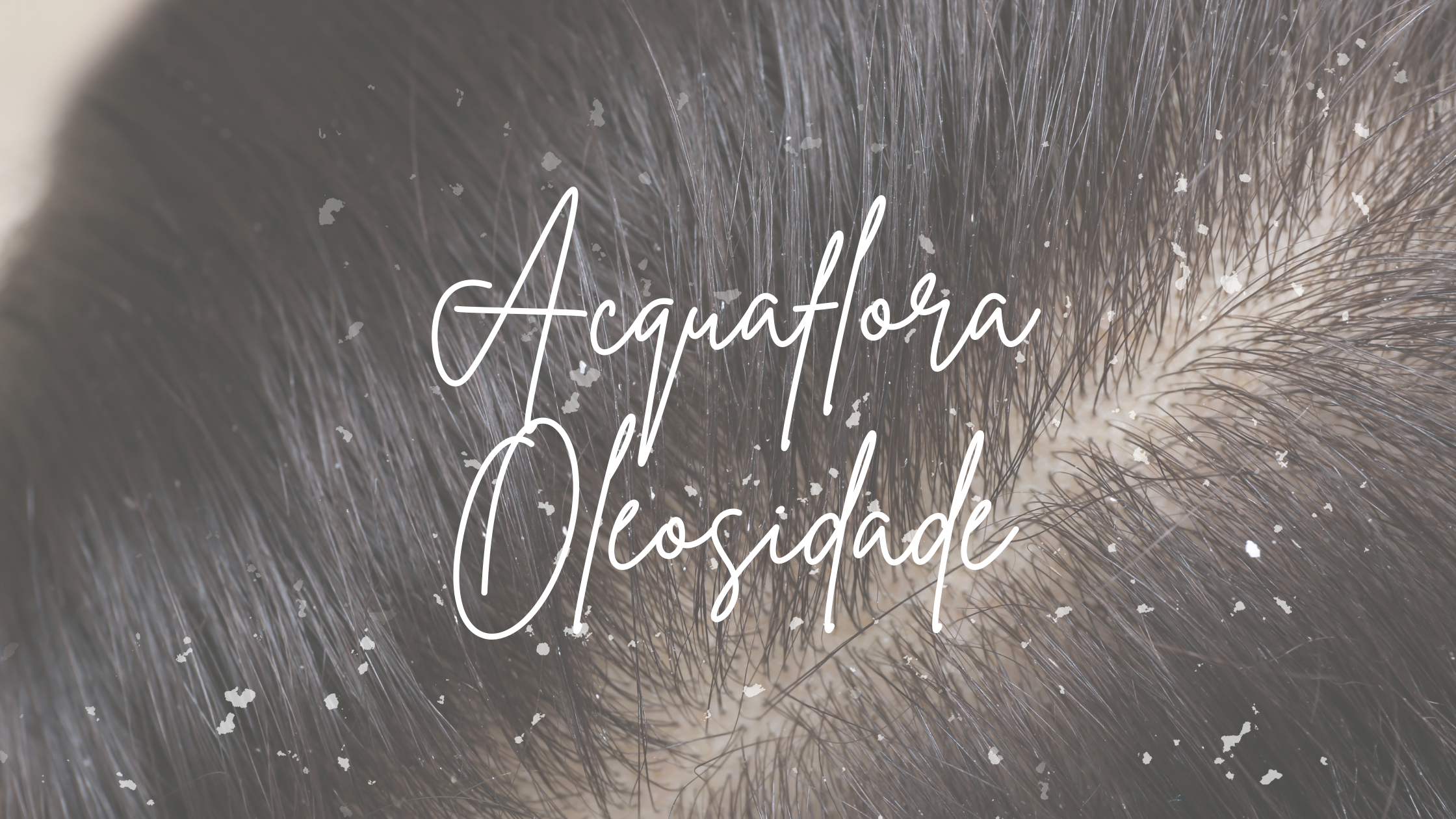 Acquaflora Equilíbrio Oleosidade: controle da oleosidade sem ressecar